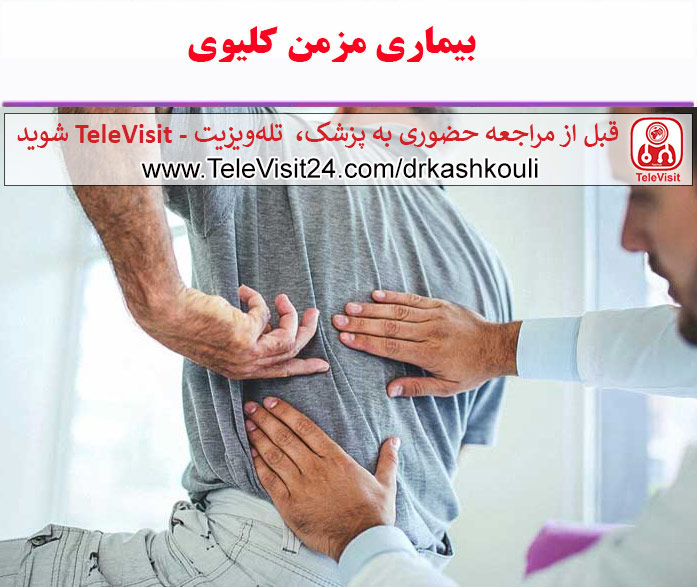 بیماری مزمن کلیوی